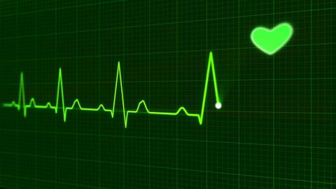 Photo courtesy of Pixabay https://pixabay.com/en/heartbeat-pulse-healthcare-medicine-163709/